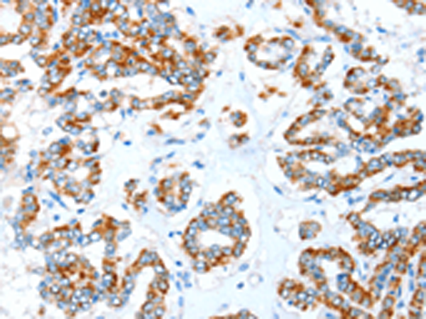 Rabbit Polyclonal Antibody to ALDH5A1