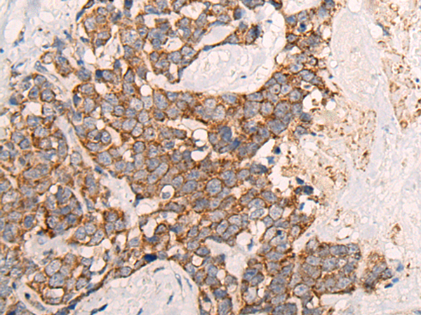 Rabbit Polyclonal Antibody to ALDH7A1