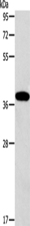 Rabbit Polyclonal Antibody to ALDOB