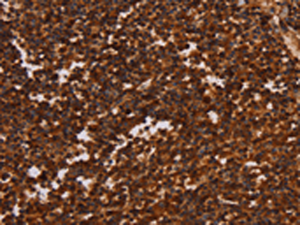 Rabbit Polyclonal Antibody to ALG11