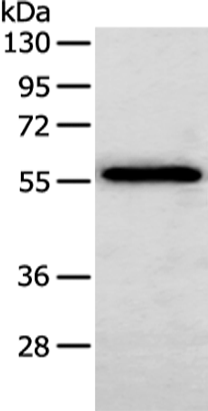 Rabbit Polyclonal Antibody to SERPINF2