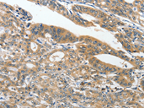 Rabbit Polyclonal Antibody to ANKZF1