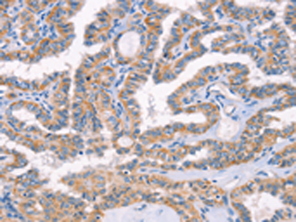 Rabbit Polyclonal Antibody to AP1B1