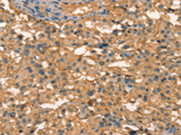 Rabbit Polyclonal Antibody to APC