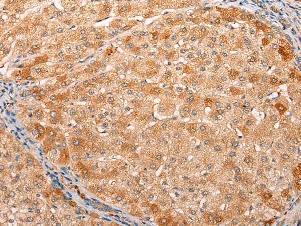 Rabbit Polyclonal Antibody to LRP8