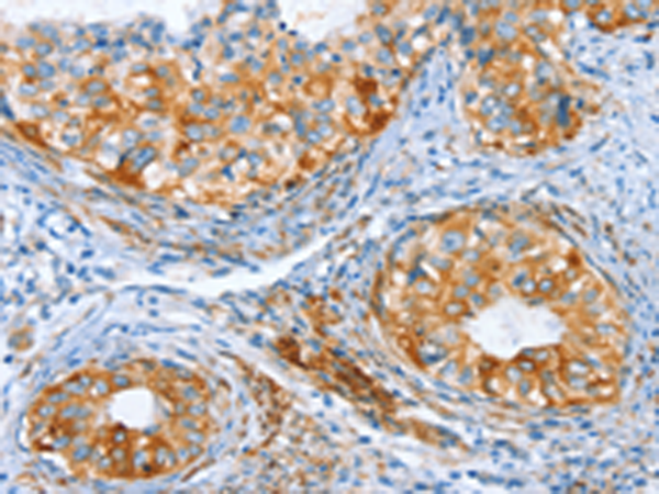 Rabbit Polyclonal Antibody to AIP