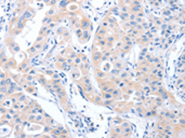 Rabbit Polyclonal Antibody to ARHGEF6
