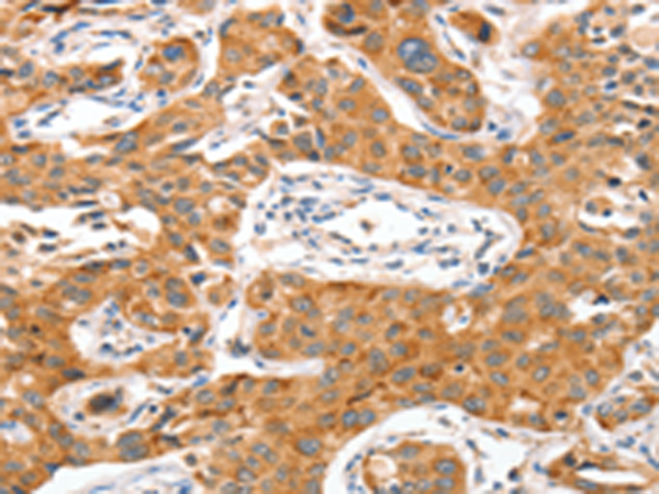 Rabbit Polyclonal Antibody to NUAK1