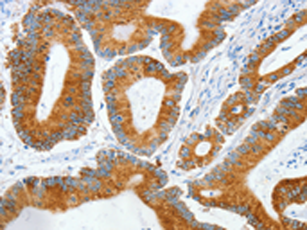 Rabbit Polyclonal Antibody to MANF