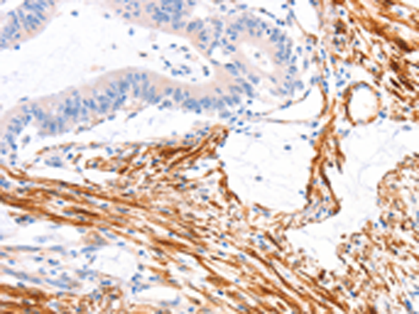 Rabbit Polyclonal Antibody to ARAP1