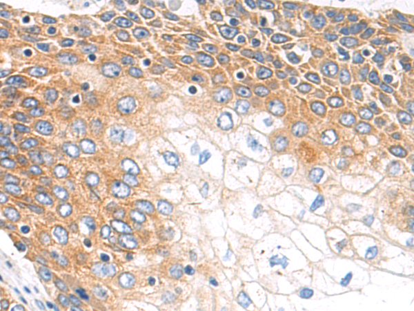 Rabbit Polyclonal Antibody to ADPRS