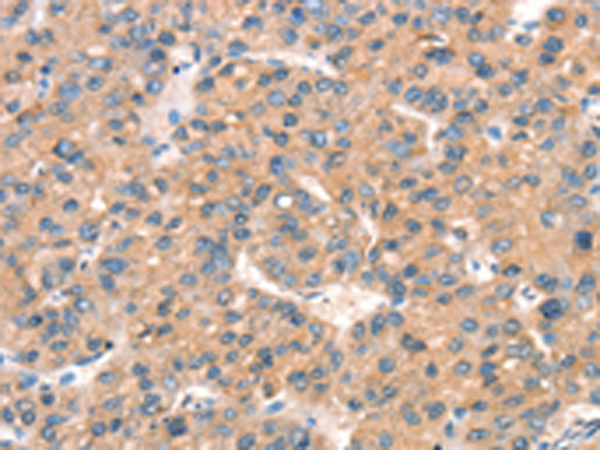 Rabbit Polyclonal Antibody to ARHGAP4