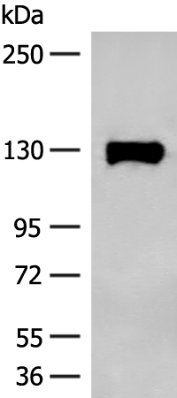 Rabbit Polyclonal Antibody to SENP6