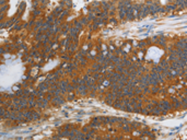 Rabbit Polyclonal Antibody to PIK3C3