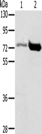 Rabbit Polyclonal Antibody to PIAS1