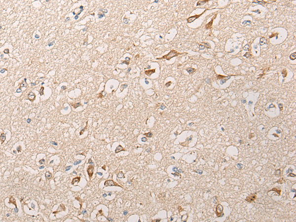 Rabbit Polyclonal Antibody to HTRA1