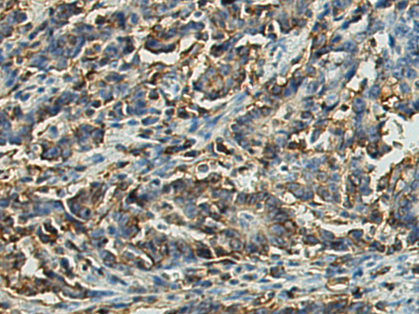 Rabbit Polyclonal Antibody to CD44