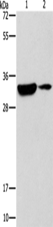 Rabbit Polyclonal Antibody to RCAN1
