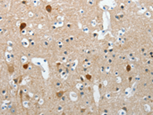 Rabbit Polyclonal Antibody to RCAN2