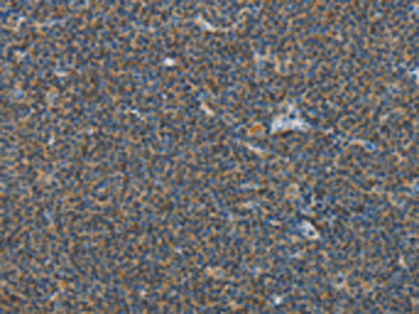 Rabbit Polyclonal Antibody to PITX3