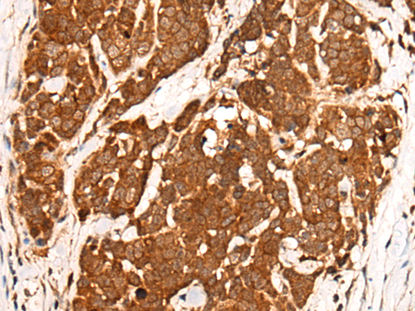 Rabbit Polyclonal Antibody to AURKA