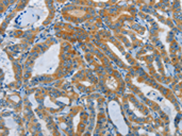 Rabbit Polyclonal Antibody to DDAH1