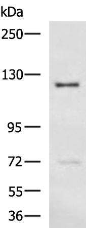 Rabbit Polyclonal Antibody to KL