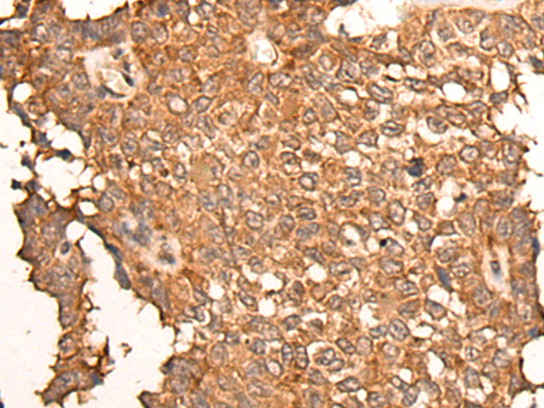 Rabbit Polyclonal Antibody to ZNF467