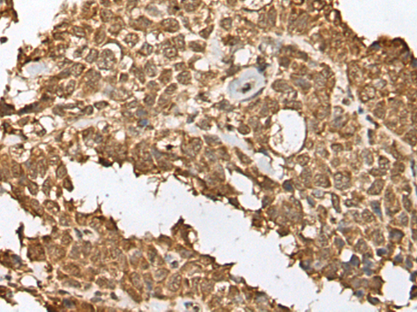 Rabbit Polyclonal Antibody to RBL2