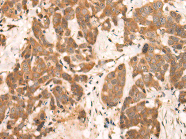 Rabbit Polyclonal Antibody to NRG2