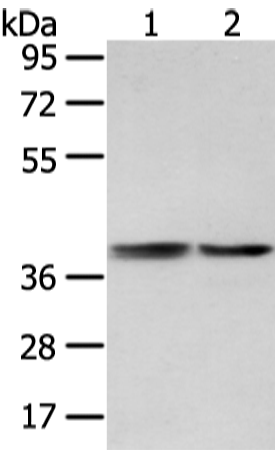 Rabbit Polyclonal Antibody to PHKG1