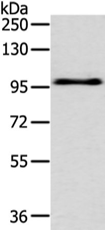 Rabbit Polyclonal Antibody to EPHA3