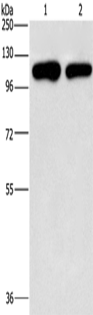 Rabbit Polyclonal Antibody to PIP5K1C