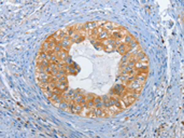 Rabbit Polyclonal Antibody to DGKZ