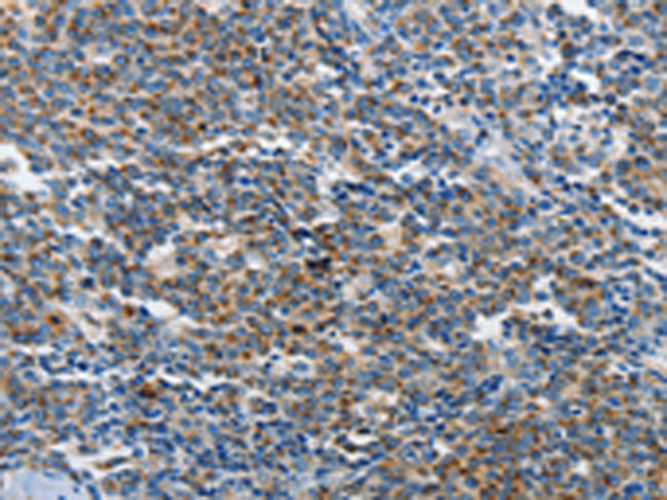 Rabbit Polyclonal Antibody to NEK1