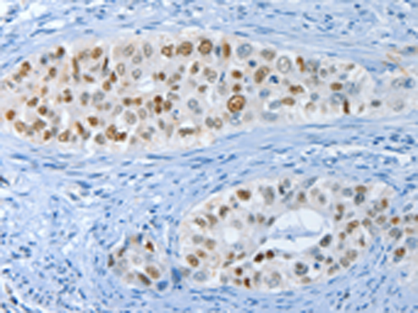 Rabbit Polyclonal Antibody to NEK4