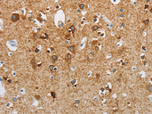 Rabbit Polyclonal Antibody to NEK5