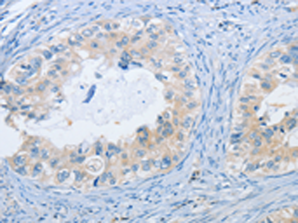 Rabbit Polyclonal Antibody to NEK9