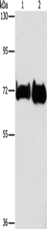 Rabbit Polyclonal Antibody to PCK1