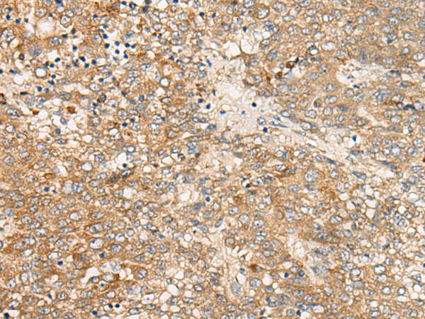 Rabbit Polyclonal Antibody to DGKI