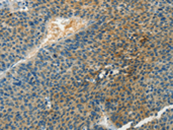 Rabbit Polyclonal Antibody to DGKB