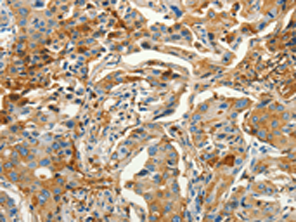 Rabbit Polyclonal Antibody to CALCA