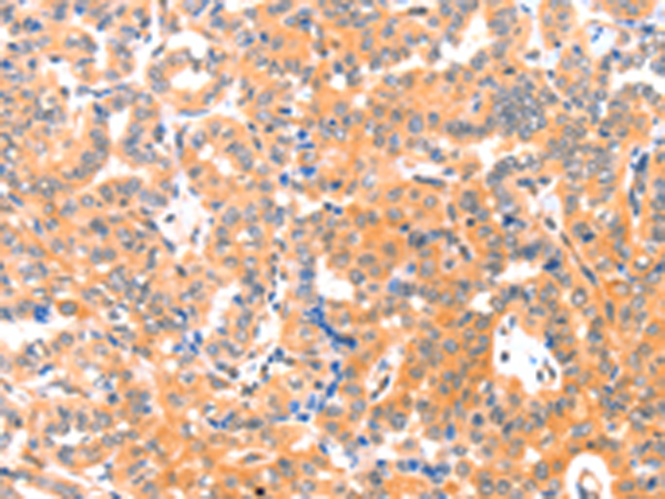 Rabbit Polyclonal Antibody to THBS1