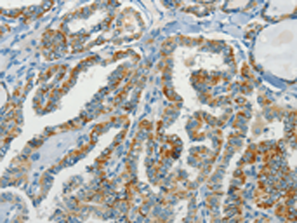 Rabbit Polyclonal Antibody to NPAP1