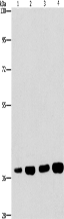 Rabbit Polyclonal Antibody to SERPINA9