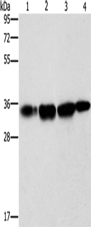 Rabbit Polyclonal Antibody to NSMCE3