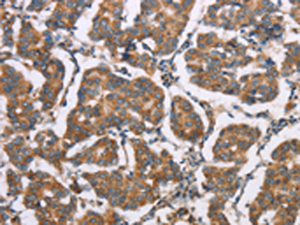 Rabbit Polyclonal Antibody to ELP3