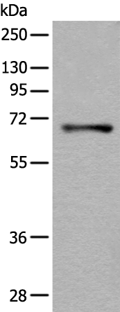 Rabbit Polyclonal Antibody to AK5