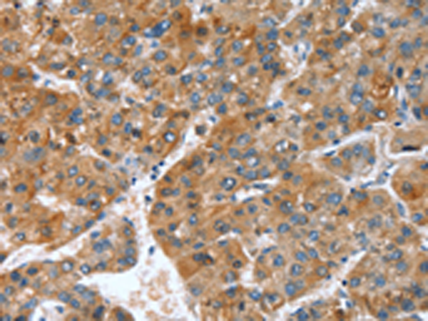 Rabbit Polyclonal Antibody to GINS1