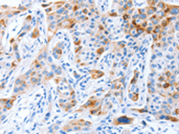 Rabbit Polyclonal Antibody to PROM1